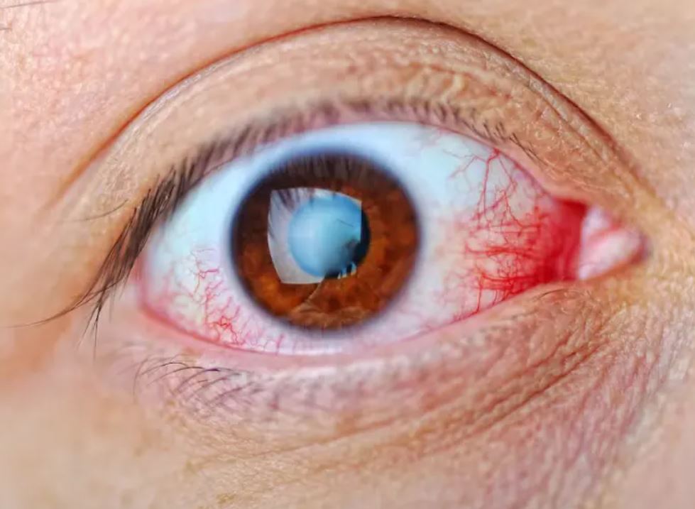आंखों की ये 5 खतरनाक बीमारियां,जिनके कारण अंधेपन का शिकार हो सकते हैं आप