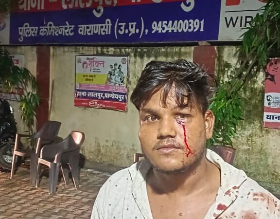 लालपुर पुलिस की निष्क्रियता से अपराधी बेलगाम