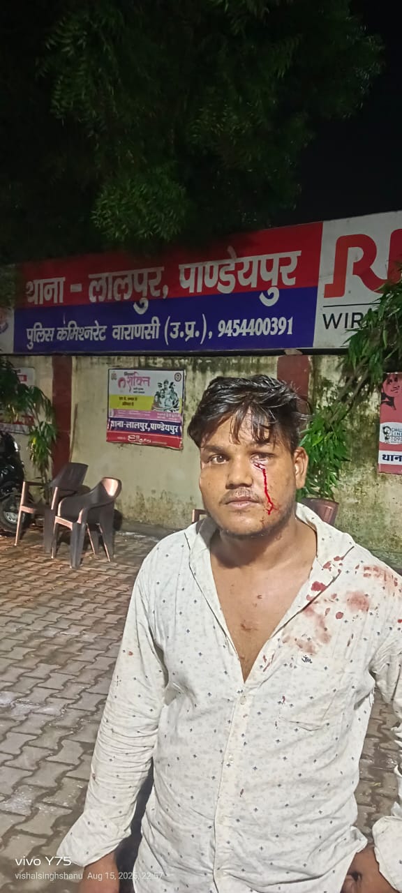 लालपुर पुलिस की निष्क्रियता से अपराधी बेलगाम