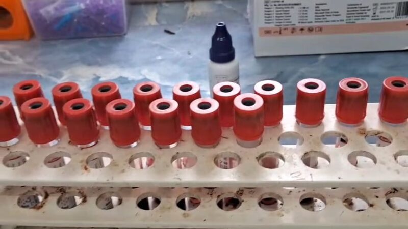 युवाओं में बढ़ रहा एचआईवी का खतरा