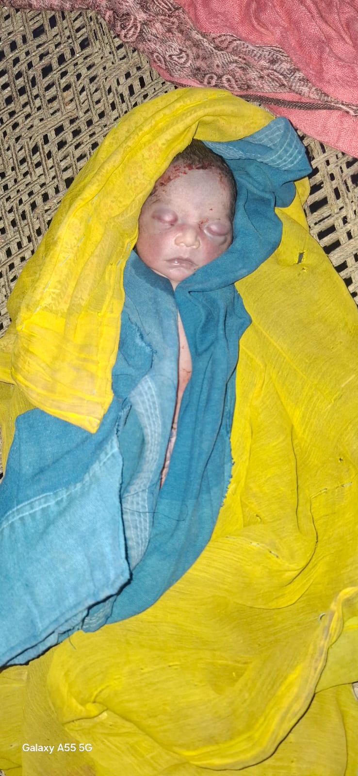 कोईराजपुर रिंग रोड के किनारे मिला लावारिस शिशु