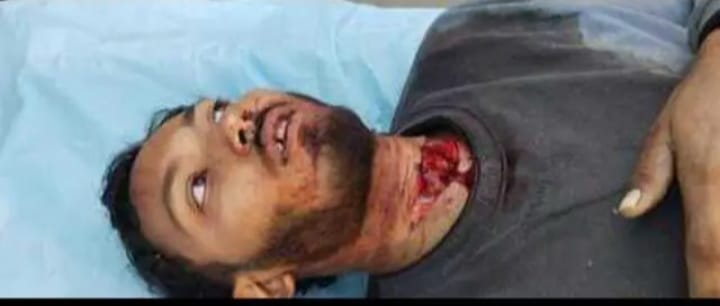 मिर्ज़ामुराद : डिलीवरी बॉय का गला रेतकर बाइक-मोबाइल और नकदी लूट ले गए बदमाश