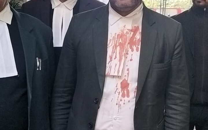 पैतृक संपत्ति के लिए बड़े भाइयों ने छोटे भाई अधिवक्ता पर  हमला