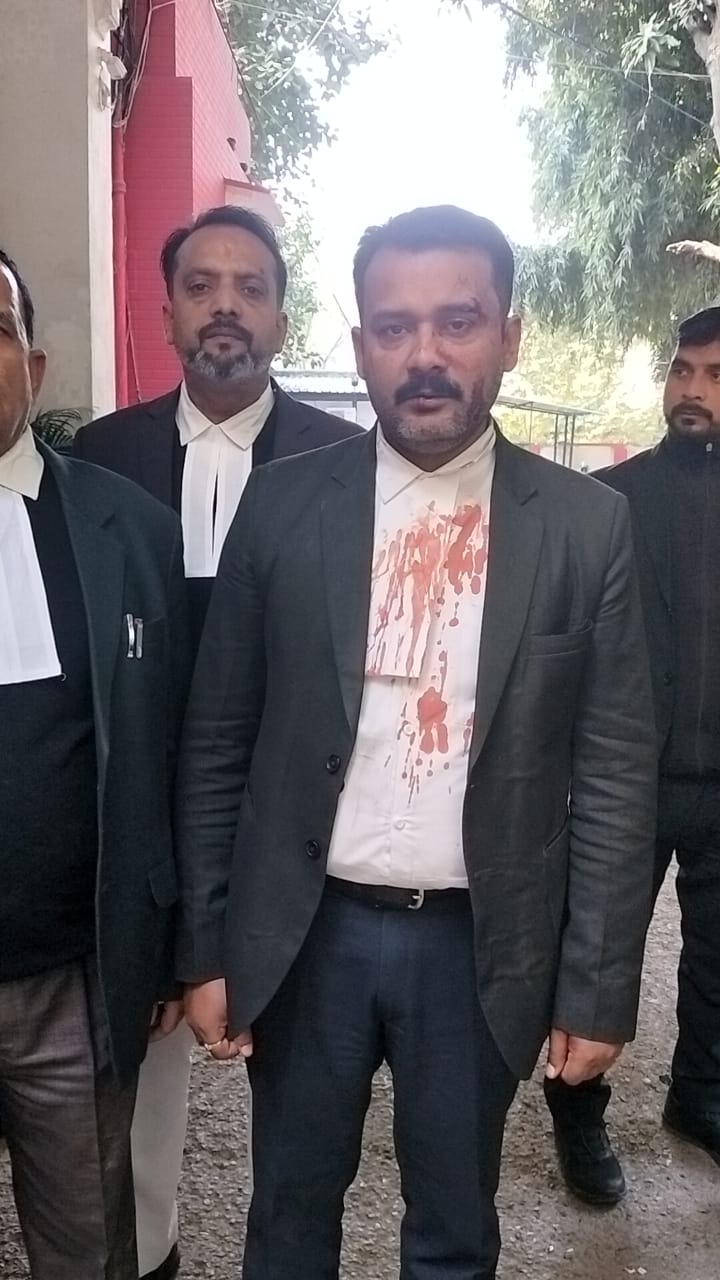 पैतृक संपत्ति के लिए बड़े भाइयों ने छोटे भाई अधिवक्ता पर  हमला