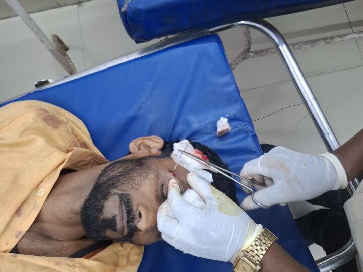 नहर किनारे पुरानी रंजिश में युवक की बेरहम पिटाई, इलाज के दौरान मौत; दो गिरफ्तार