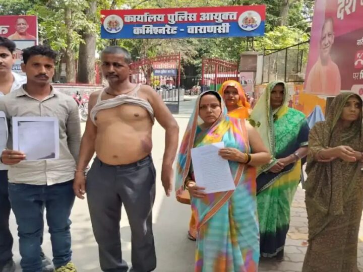 चोलापुर : आम तोड़ने के विवाद में मारपीट, पीड़ित परिवार ने पुलिस पर लगाया अनदेखी का आरोप