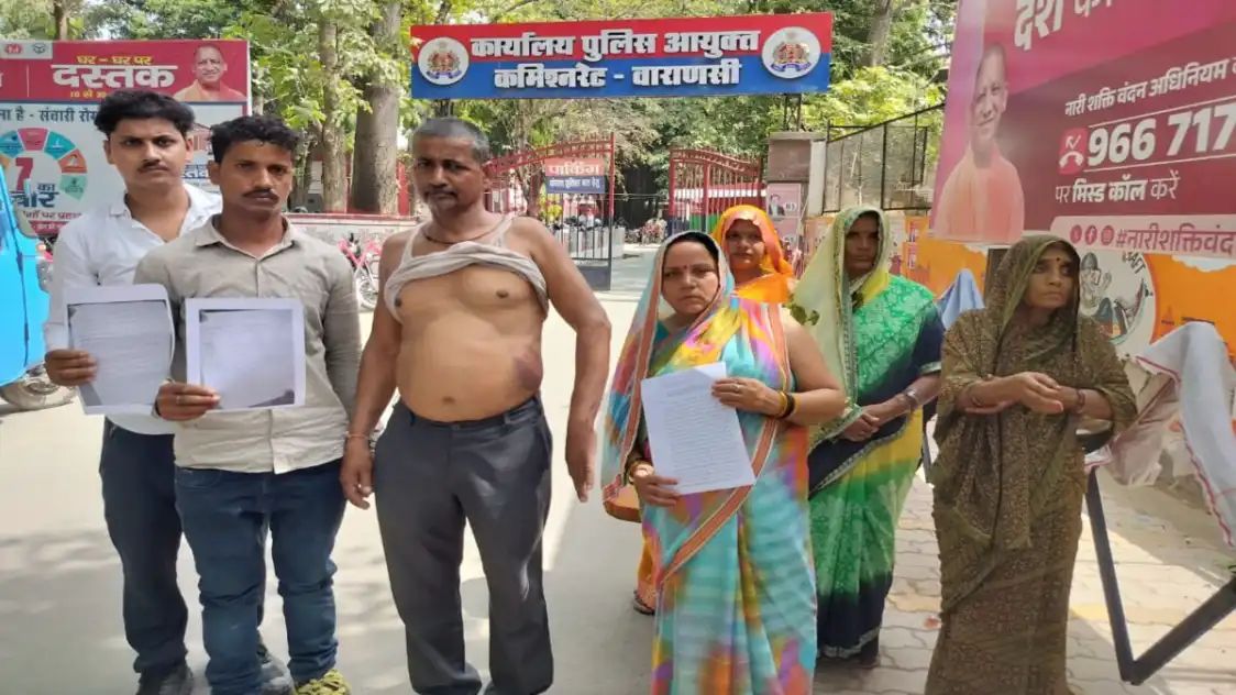 चोलापुर : आम तोड़ने के विवाद में मारपीट, पीड़ित परिवार ने पुलिस पर लगाया अनदेखी का आरोप