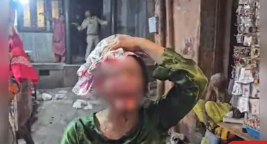 बांके बिहारी मंदिर के पास मकान का छज्जा गिरा, कई श्रद्धालु घायल