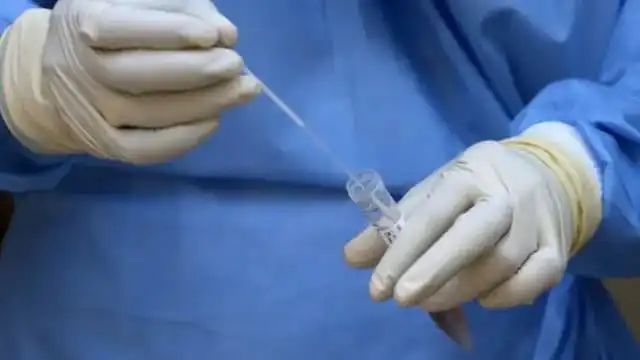 वाराणसी में युवक कोरोना संक्रमित, बीएचयू में भर्ती