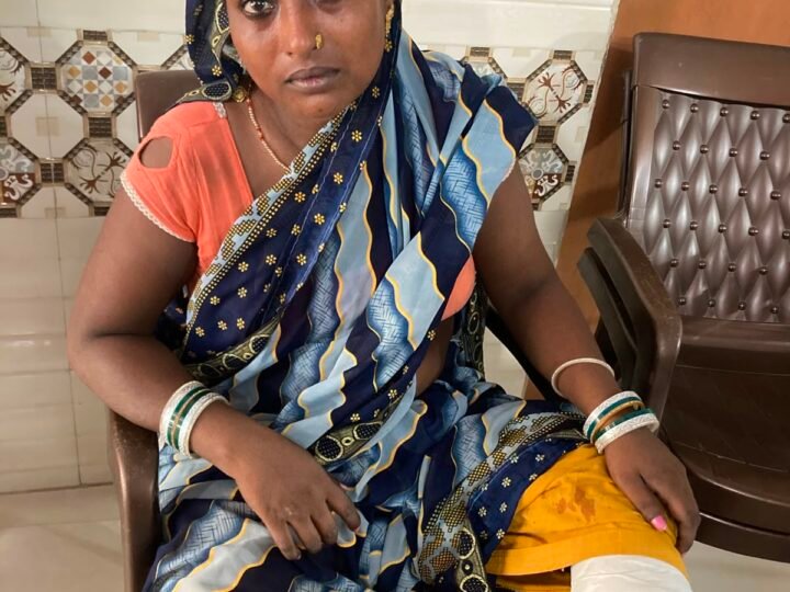 आवारा कुत्ते का आतंक, 24 घंटे में मासूम समेत आधा दर्जन से अधिक लोगों को काटा