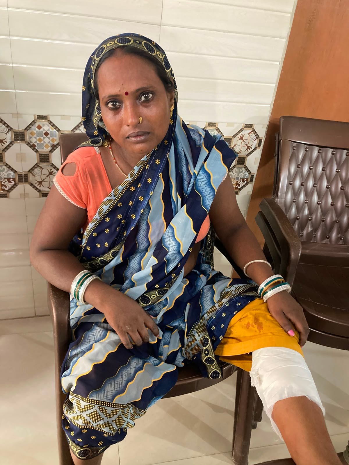 आवारा कुत्ते का आतंक, 24 घंटे में मासूम समेत आधा दर्जन से अधिक लोगों को काटा