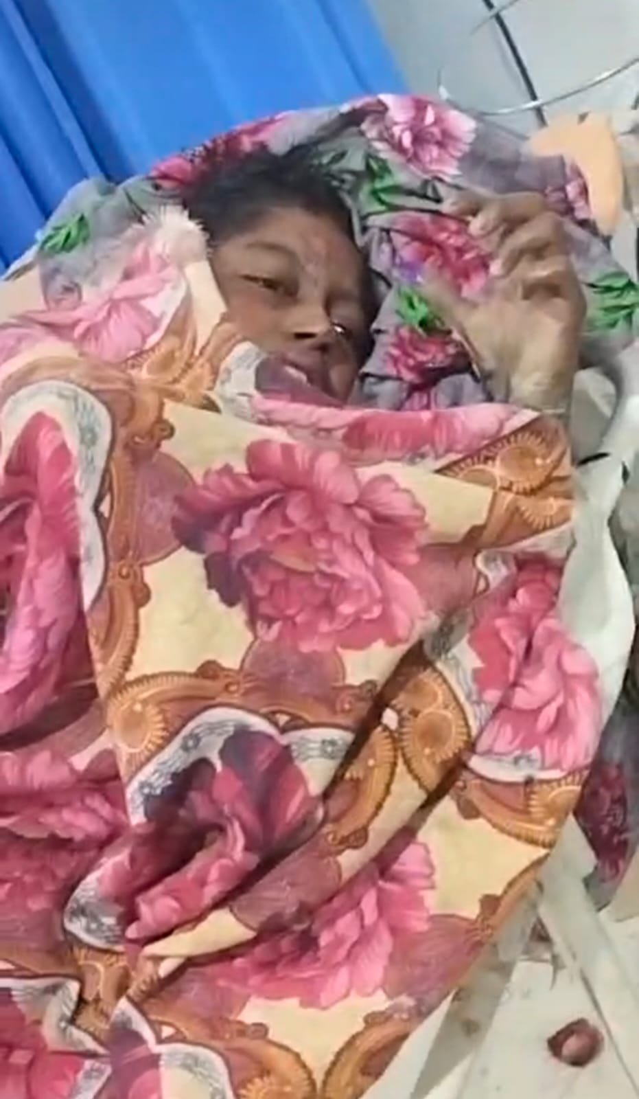 दहेज में एक लाख रुपये की मांग पूरी न होने पर विवाहिता को जलाने का आरोप