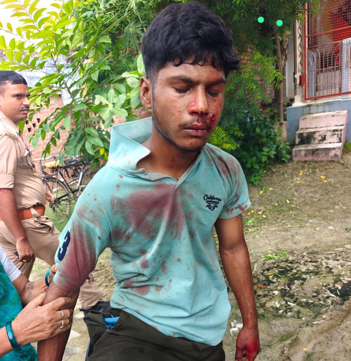 रील बनाने के दौरान चली गोली, 17 वर्षीय युवक घायल
