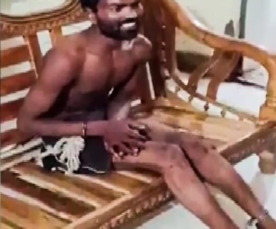 नशे में बेटे ने मां को जिंदा जलाया, मौत का आरोप