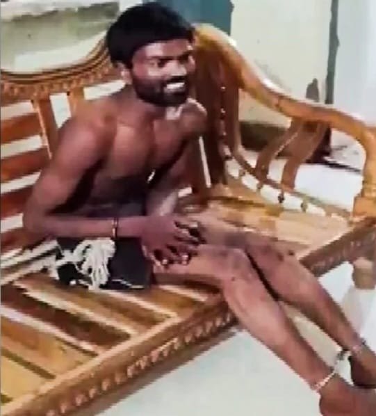 नशे में बेटे ने मां को जिंदा जलाया, मौत का आरोप